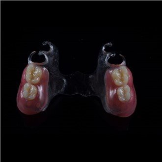 Подвижна акрилна частична протеза