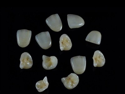 Как да изберем най-доброто стоматологично лепило за корони: най-ново ръководство