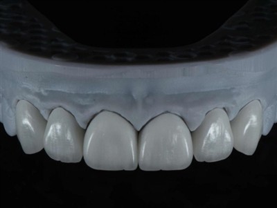 Как да възложите работа на зъболекарски лаборант в чужбина: изчерпателно ръко...